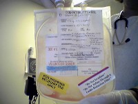 Empty Bone Marrow Bag