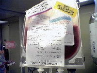 Picture of Label On Bone Marrow (Upside-Down]