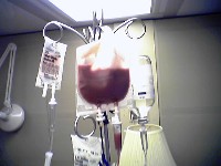 Second Set Of Bone Marrow